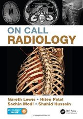 book On Call Radiology