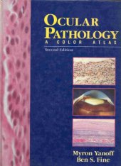 book Ocular pathology : a color atlas