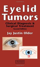 book Eyelid Tumours: Clinical Diagnosis and Surgical Treatment