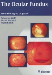 book The Ocular Fundus: From Findings to Diagnosis