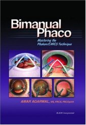 book Bimanual Phaco: Mastering the Phakonit/MICS Technique