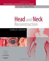 book Head and Neck Reconstruction