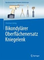 book Bikondylärer Oberflächenersatz Kniegelenk