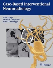 book Case-based interventional neuroradiology