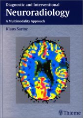 book Diagnostic and Interventional Neuroradiology