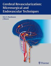 book Cerebral revascularization: microsurgical and endovascular techniques