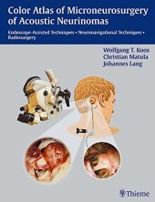 book Color atlas of microneurosurgery of acoustic neurinomas: endoscope-assisted techniques, neuronavigational techniques, radiosurgery