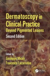 book Dermatoscopy in Clinical Practice