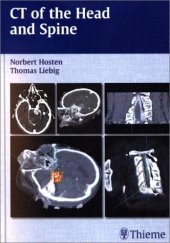 book CT of the head and spine