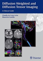 book Diffusion weighted and diffusion tensor imaging: a clinical guide