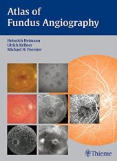 book Atlas of fundus angiography