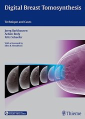 book Digital breast tomosynthesis: technique and cases