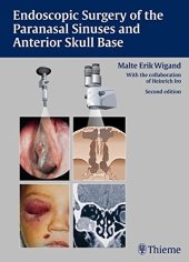 book Endoscopic surgery of the paranasal sinuses and anterior skull base