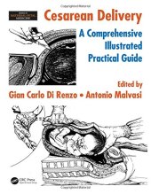 book Cesarean delivery: a comprehensive illustrated practical guide