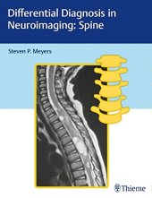 book Differential diagnosis in neuroimaging. Spine