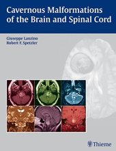 book Cavernous malformations of the brain and spinal cord