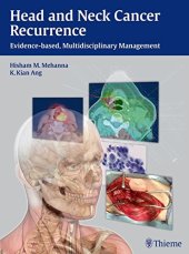 book Head and neck cancer recurrence: evidence-based, multidisciplinary management