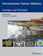 book Percutaneous tumor ablation: strategies and techniques