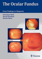 book The ocular fundus: from findings to diagnosis