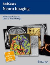 book Radcases Neuro Imaging