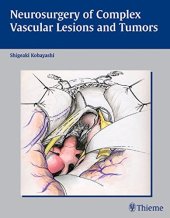 book Neurosurgery of complex vascular lesions and tumors