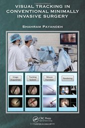 book Visual tracking in conventional minimally invasive surgery