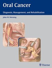 book Oral cancer: diagnosis, management, and rehabilitation