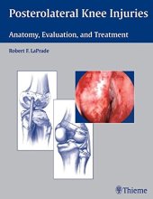 book Posterolateral knee injuries: anatomy, evaluation, and treatment