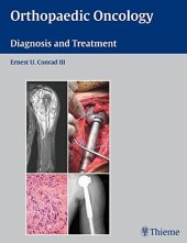 book Orthopaedic oncology: diagnosis and treatment