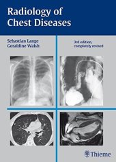 book Radiology of chest diseases