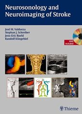 book Neurosonology and Neuroimaging of Stroke: A Comprehensive Reference