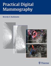 book Practical digital mammography