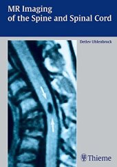 book MR imaging of the spine and the spinal cord