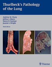 book Thurlbeck’s pathology of the lung