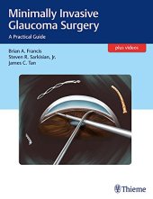 book Minimally invasive glaucoma surgery: a practical guide