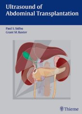 book Ultrasound of abdominal transplantation