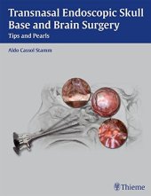 book Transasal endoscopic skull base and brain surgery: tips and pearls