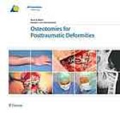 book Osteotomies for posttraumatic deformities