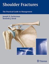 book Shoulder fractures: the practical guide to management