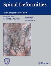 book Spinal deformities: the comprehensive text