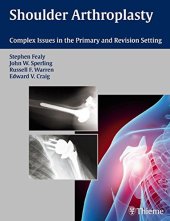 book Shoulder arthroplasty: complex issues in the primary and revision setting