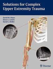 book Solutions for complex upper extremity trauma