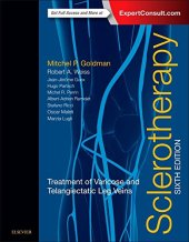 book Sclerotherapy: Treatment of Varicose and Telangiectatic Leg Veins