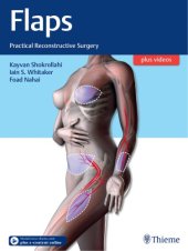 book Flaps : practical reconstructive surgery