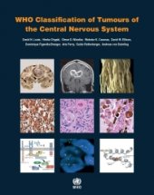 book WHO Classification of Tumours of the Central Nervous System