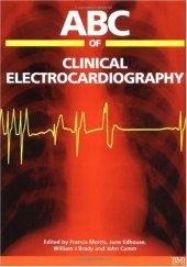 book ABC of clinical electrocardiography