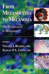 book From melanocytes to melanoma: the progression to malignancy