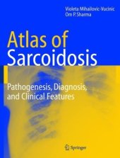 book An Atlas of Sarcoidosis
