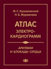 book Аритмии и блокады сердца: атлас электрокардиограмм