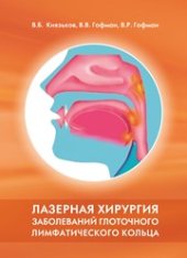 book Лазерная хирургия заболеваний глоточного лимфатического кольца